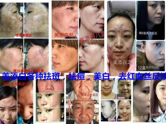 这是第8张美添白修正大品牌产品的货源图片