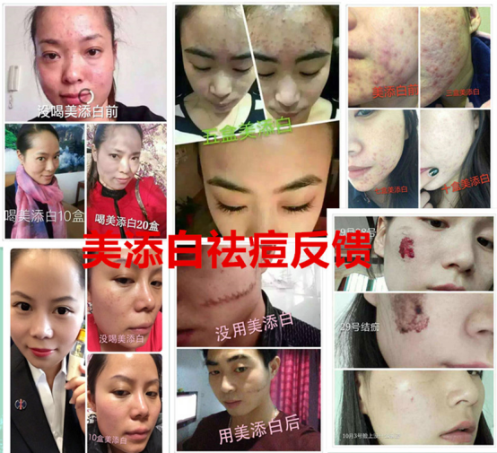 这是第10张美添白修正大品牌产品的货源图片